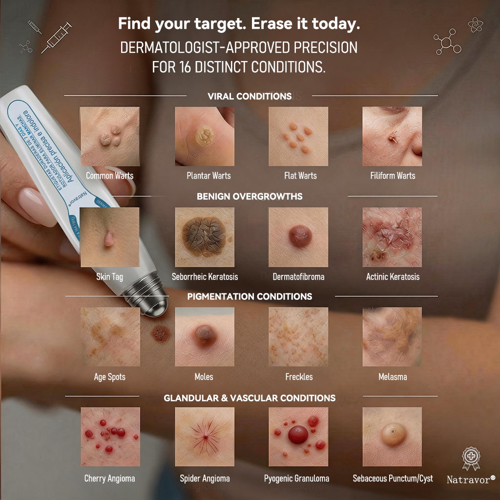 🎁Only 5 left — Add your second one and get 50% OFF! |✅🎉Natravor® 7-𝐷𝑎𝑦 𝗧𝐚𝐠 & 𝗦𝗽𝐨𝐭 𝐄𝐫𝒂𝒔𝒆𝒓(Zero Pain, Zero 𝐒𝐜𝐚𝒓𝒔 Rollerball)