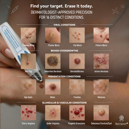 🎁Only 5 left — Add your second one and get 50% OFF! |✅🎉Natravor® 7-𝐷𝑎𝑦 𝗧𝐚𝐠 & 𝗦𝗽𝐨𝐭 𝐄𝐫𝒂𝒔𝒆𝒓(Zero Pain, Zero 𝐒𝐜𝐚𝒓𝒔 Rollerball)